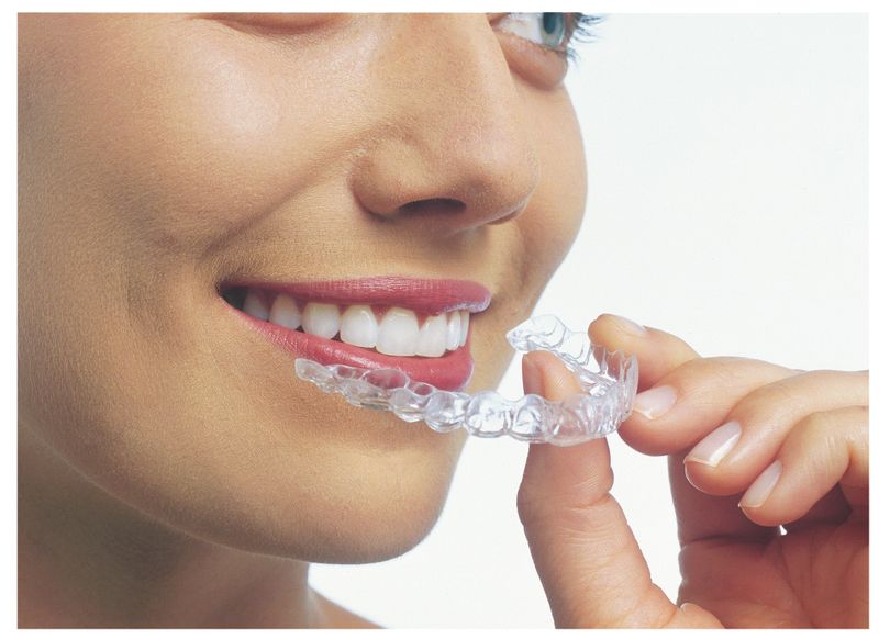 In Getting The Invisalign Teen 23